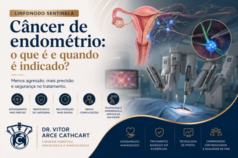 Ilustração sobre a pesquisa do linfonodo sentinela no câncer de endométrio, técnica utilizada durante a cirurgia robótica para avaliação da disseminação da doença.